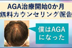 AGA治療開始0か月