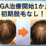 AGA治療1か月目、初期脱毛無し