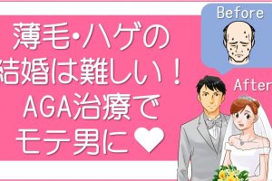 薄毛・ハゲの結婚は難しい