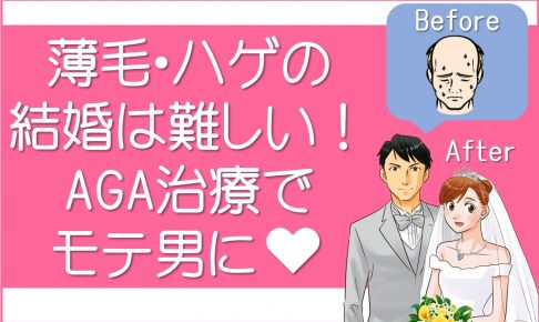 薄毛・ハゲの結婚は難しい