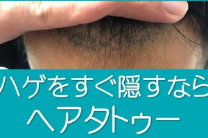 ハゲをすぐ隠すなら短髪よりヘアタトゥー