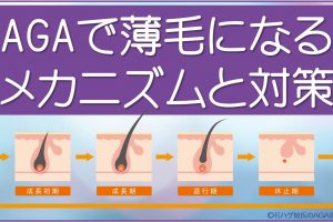 AGAで薄毛になるメカニズム