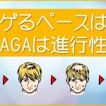 ハゲるペースは？AGAは進行性