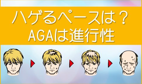 ハゲるペースは？AGAは進行性