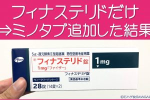 フィナステリドにミノタブ追加