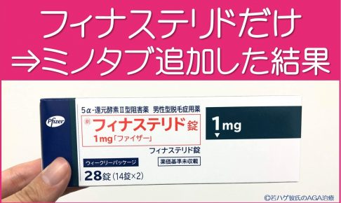 フィナステリドにミノタブ追加