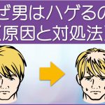 なぜはげるのか原因と対処法