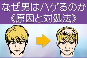 なぜはげるのか原因と対処法
