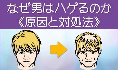 なぜはげるのか原因と対処法