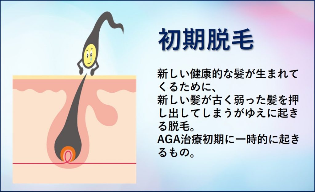 初期脱毛の説明