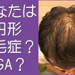 あなたは円形脱毛症？AGA？