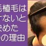 自毛植毛のメリットデメリット