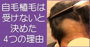 自毛植毛のメリットデメリット