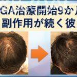AGA治療9か月副作用が続く彼