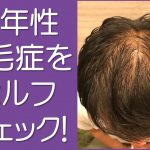 壮年性脱毛症をセルフチェック
