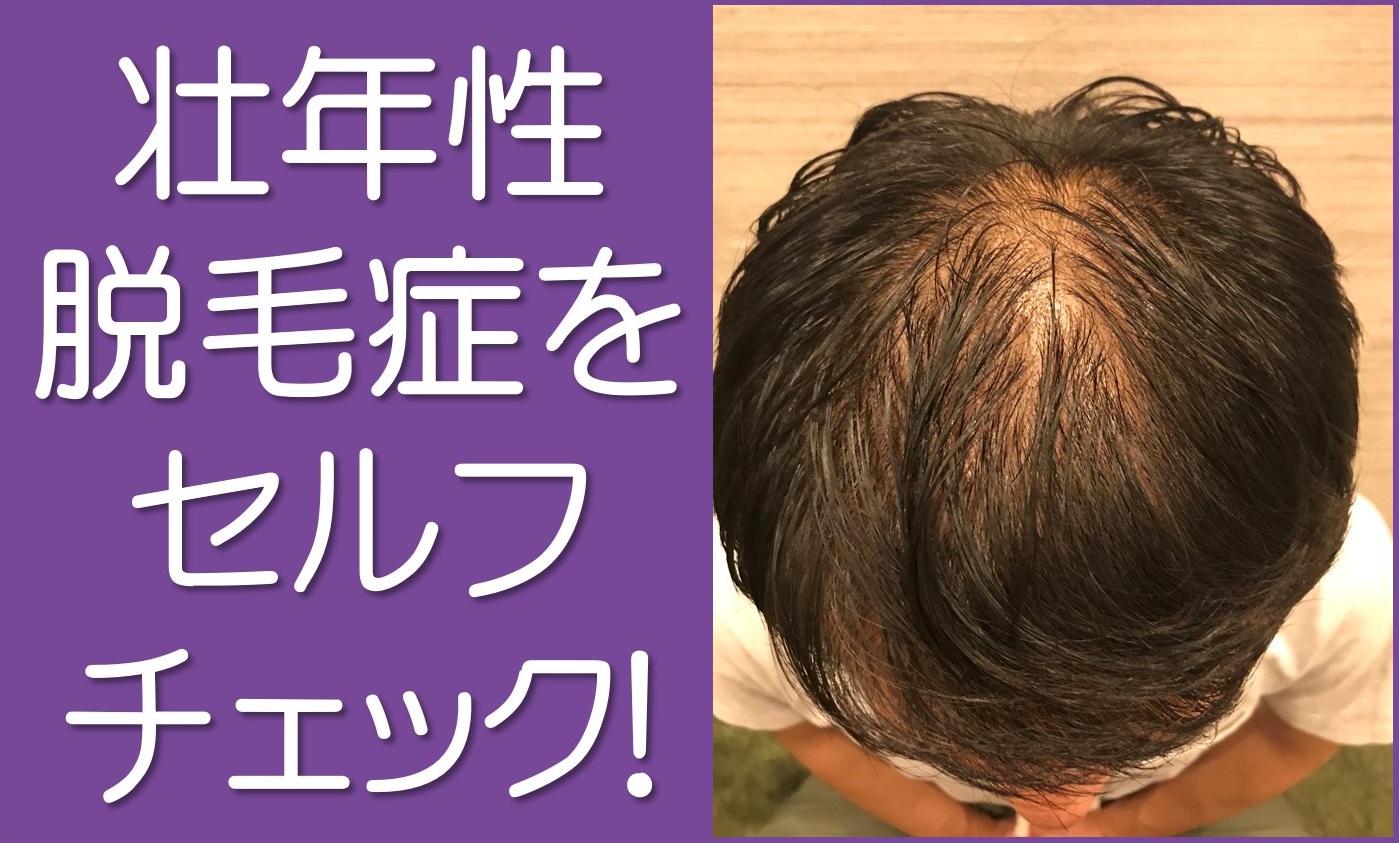 薬剤性脱毛症の兆候