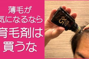 安い市販の育毛剤は買うな