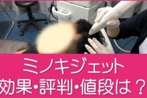ミノキジェット効果・評判・値段は