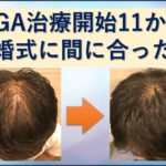 結婚式に間に合った11か月目