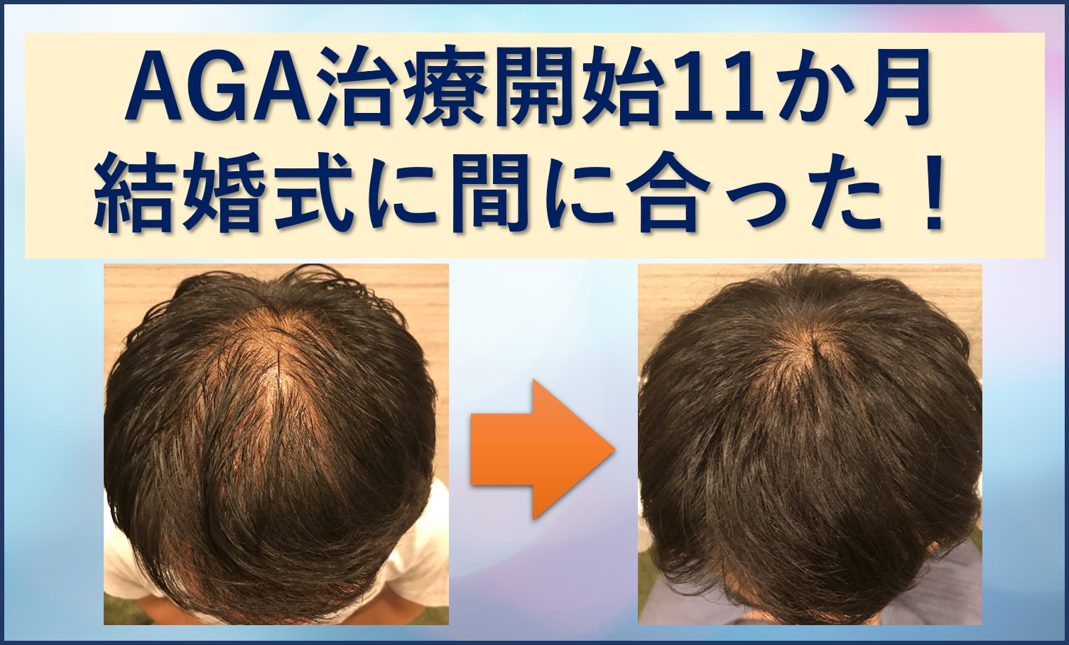 結婚式に間に合った11か月目