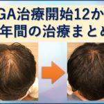 AGA治療1年間のまとめ