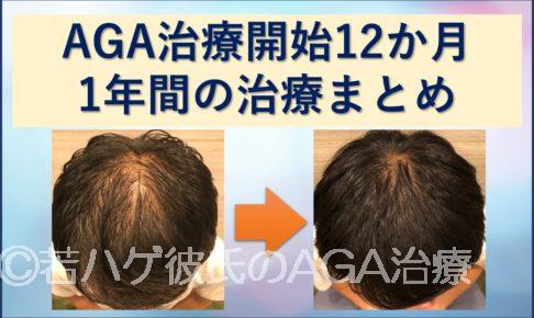 AGA治療1年間のまとめ